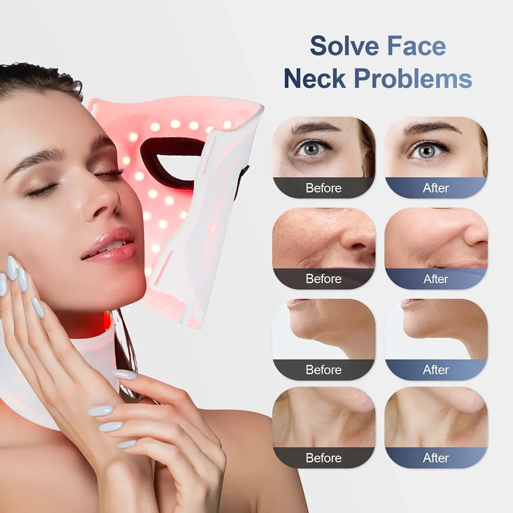 LED Light Therapy Mask – Face & Neck, 7 Colors, Cordless & Rechargeable